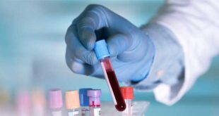 Αιματολογική εξέταση μπορεί να προβλέψει τη νόσο του Crohn