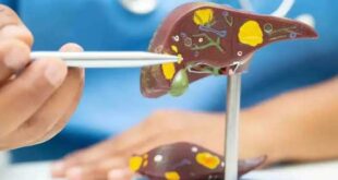 Ηπατική ίνωση: Η αθέατη απειλή για τη δημόσια υγεία