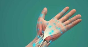 Σύνδρομο καρπιαίου σωλήνα: Επτά πιθανές –και μη αναμενόμενες– αιτίες