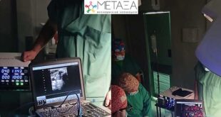 Νοσοκομείο Μεταξά: Για πρώτη φορά στο ΕΣΥ θερμική κατάλυση θυρεοειδικών όζων με μικροκύματα