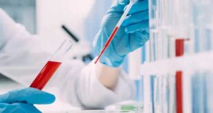 Alzheimer: Διαθέσιμη και στην Ελλάδα η πρώτη εξέταση αίματος που συμβάλλει στον αποκλεισμό της νόσου