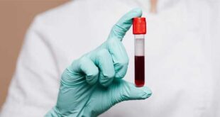 Μπορεί μια εξέταση αίματος να αλλάξει το μέλλον της έγκαιρης διάγνωσης του καρκίνου;